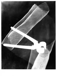 Photogramme avec pinces, 1920